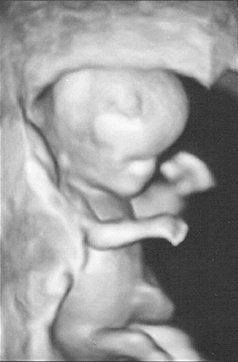 Baby at 11 weeks